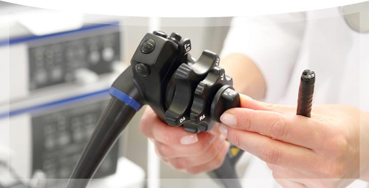 内視鏡のイメージ写真